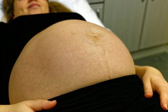 Smart Fertility Choices Smart Fertility Choices