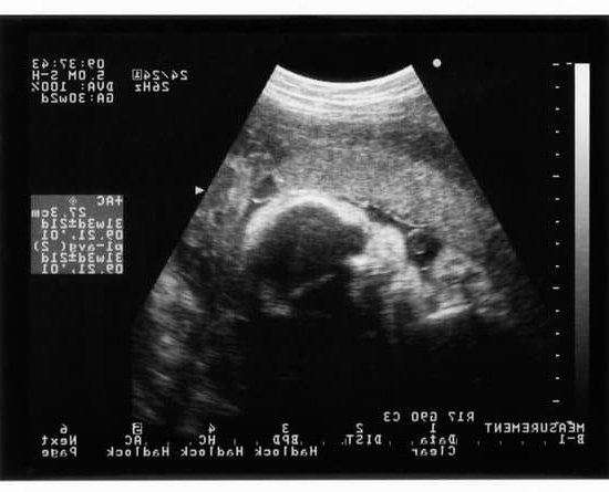 Pregnancy Test Blank Pregnancy Test Blank