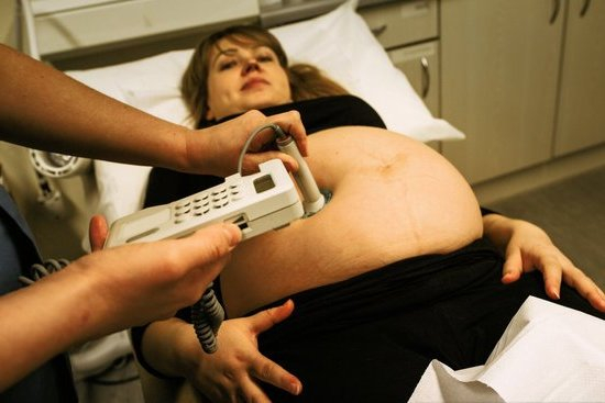 20 Week Pregnancy Ultrasound