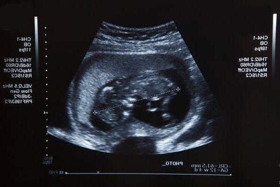 Gold Discharge Early Pregnancy