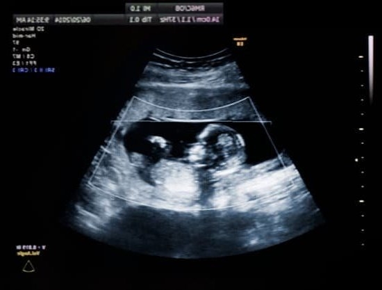 How Many Pregnancy Tests Should I Take If Negative How Many Pregnancy Tests Should I Take If Negative