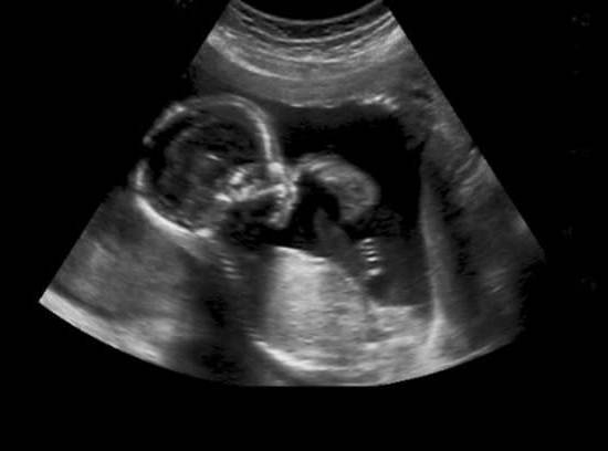 Are Nasal Sprays Safe For Pregnancy