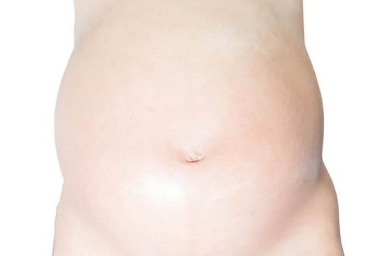 How Does Mifepristone Stop Pregnancy How Does Mifepristone Stop Pregnancy