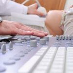 How to Avoid Stretch Marks During Pregnancy Tips for Prevention and Treatment