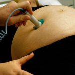 Green Discharge During Pregnancy Potential Infection Symptoms