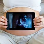 Best Pregnancy Apps Stay organized and informed with these top-rated pregnancy tracking and health apps