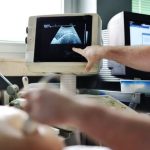 Is Cramping Normal in Early Pregnancy