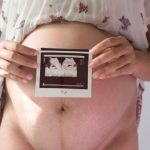 Can Early Pregnancy Cause Diarrhea exploring causes and solutions