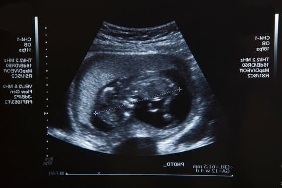 When Does Pregnancy Start When does pregnancy start - An embryo forms when sperm fertilizes an egg