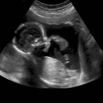 First Pregnancy Symptoms Nausea, Fatigue, and Mood Swings - Guide for Expecting Moms