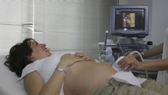 How Long Is Full Term Pregnancy A Guide to Pregnancy Duration and What to Expect