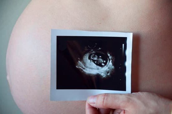 Are Hiccups a Sign of Pregnancy Discover if hiccups indicate pregnancy