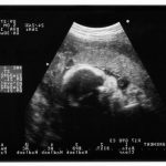 Pregnancy cravings typically start in the first trimester